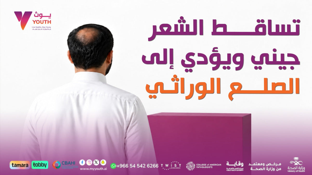 تساقط الشعر والصلع الوراثي